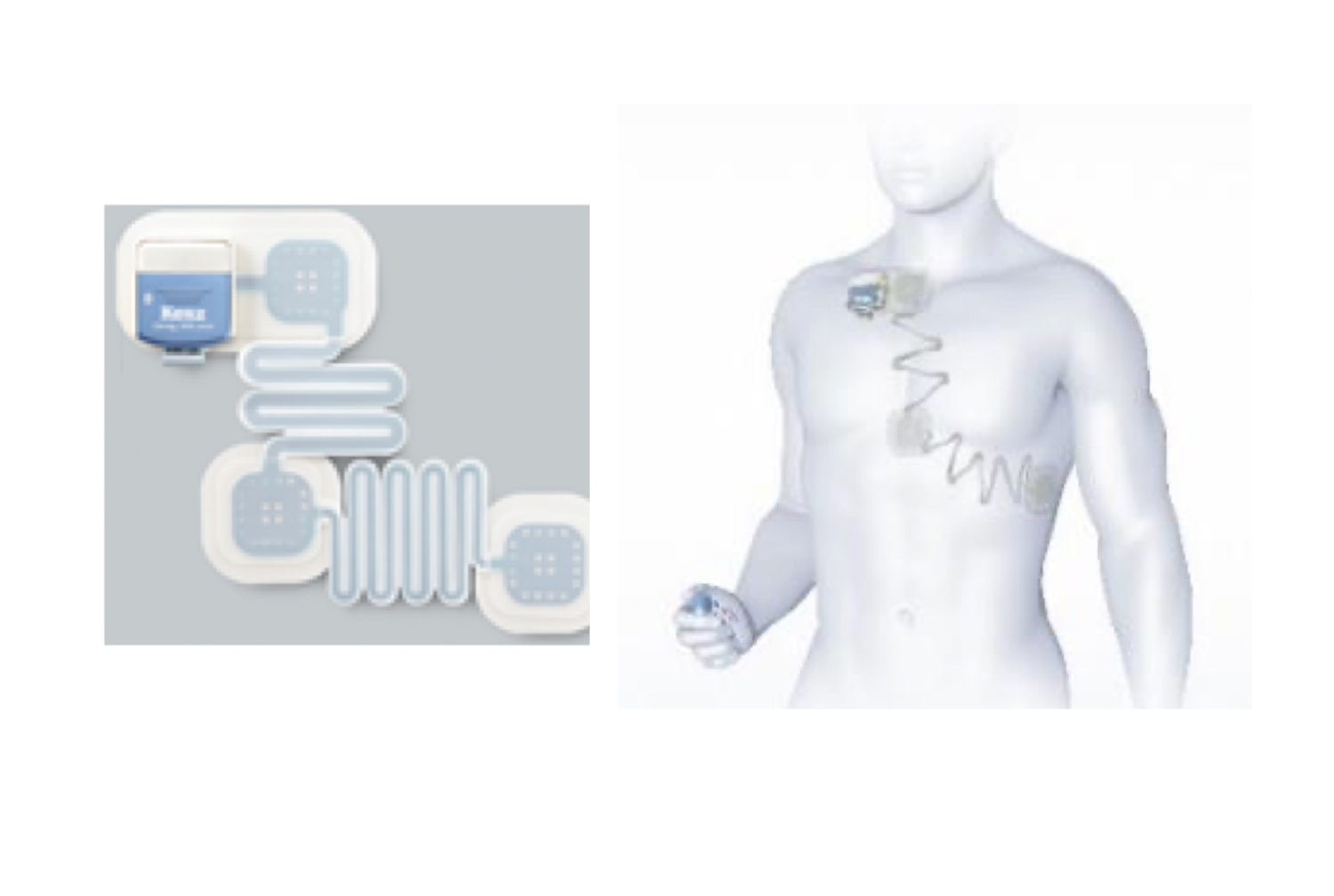 24時間ホルター心電図