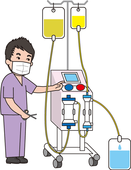腹水濾過濃縮処理